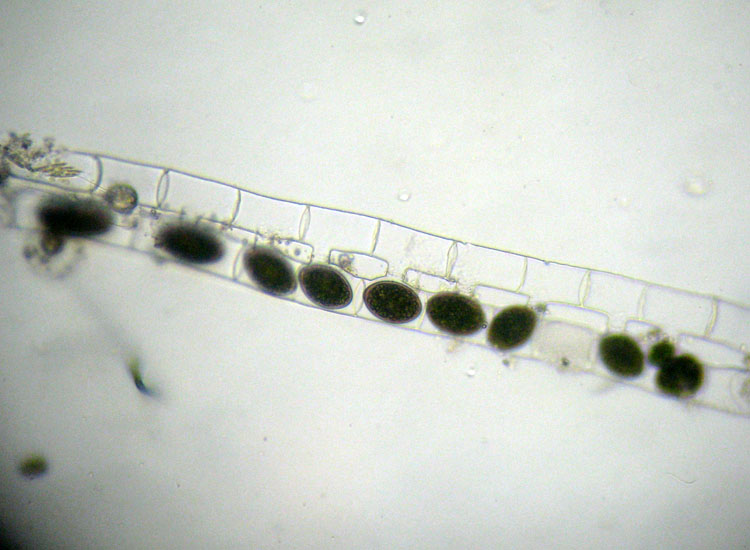 Alghe 3: Spirogyra sp